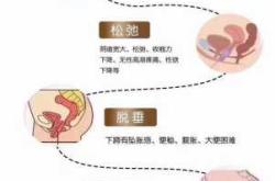 产后日韩修复方法有哪些