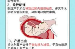 剖腹产小孩多久能出来