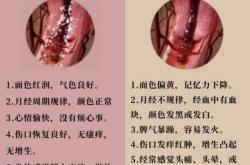 剖腹产伤口左边牵扯疼咋回事