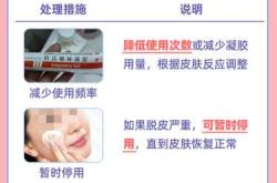 产后脸上脱皮是怎么回事