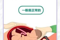 产后两个月会来月经吗