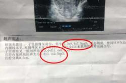 产后流血一般几天干净