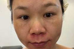 坐月子期间能护肤擦脸吗