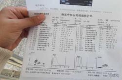 引产后多久复查b超最好