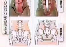 剖腹产能做平板支撑吗