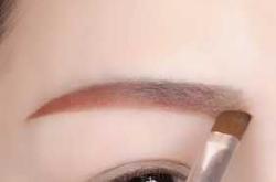 新生儿眉骨异常该怎么办