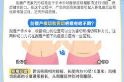 明星剖腹产如何祛疤