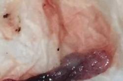 怀孕后能查出流产史吗