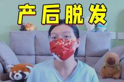 产后脱发怎么治疗