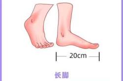 婴儿猛长期该注意什么