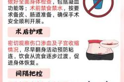 女性剖腹产结扎到底好不好