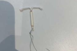 流产后上环好不好