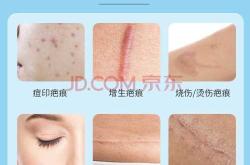 剖腹产伤口护理凝胶怎么选