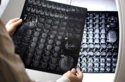 男方做磁共振影响备孕吗