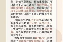 尿不湿会导致宝宝O型腿吗