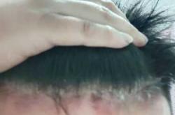 月子风湿病有啥症状