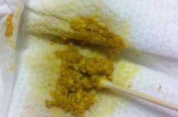 新生儿大便糊状正常吗