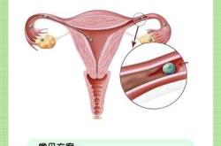 备孕紧张怀不上怎么办