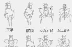 产后一直腰酸是怎么回事