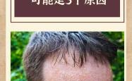 婴儿盗汗是什么原因引起的