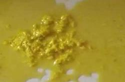 婴儿大便黄中带绿是怎么回事