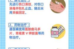 产后大拇指疼怎么办