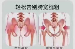 产后做骨盆修复会疼吗