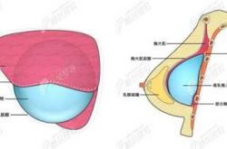 备孕前能否打玻尿酸针