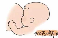 婴儿为何裹奶头