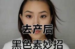 产后黑色素如何消除