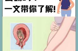 剖腹产伤气血吗