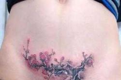 剖腹产疤痕纹身有啥图片