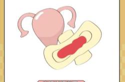 剖腹产恶露血块如何排出