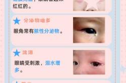 新生儿眼科需要注意什么