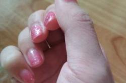 产后嘴笨怎么办