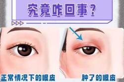 婴儿眼睑肿是怎么回事