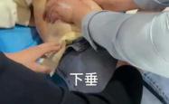 顺产后下腹痛是怎么回事