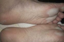 婴儿脚底发白是怎么回事