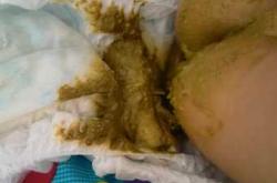 新生儿每天大便十几次正常吗