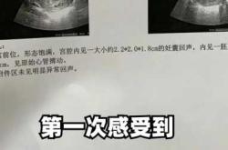 产后能不能喝蛋白粉