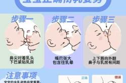 婴儿乳头需不需要挤