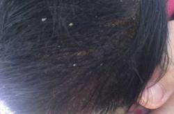 新生儿头好长是怎么回事