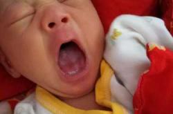 鹏鹏为什么要剖腹产