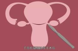 剖腹产清宫原因是什么