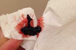 流产后淤血多久排干净