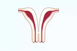 十个月婴儿口臭咋回事