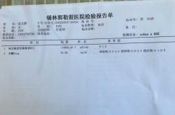 正常体检能查出怀孕吗