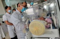 台州剖腹产咋选日子