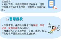 孕反严重验尿有什么不同