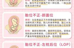 枕右前位能顺产吗